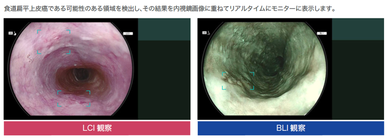 部位ごとの検出支援モード画像