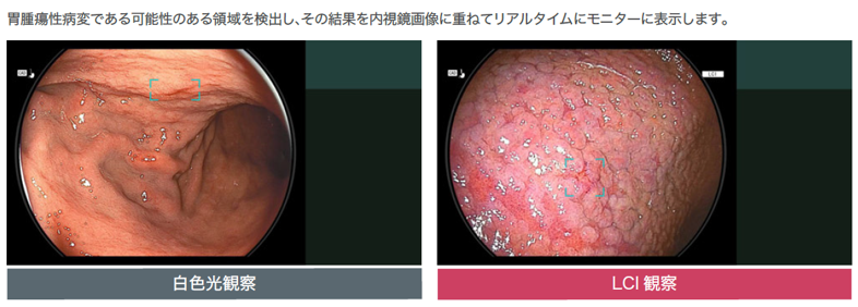 部位ごとの検出支援モード画像